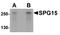 Zinc Finger FYVE-Type Containing 26 antibody, A06231, Boster Biological Technology, Western Blot image 