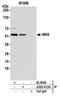 MAPK Activated Protein Kinase 5 antibody, A302-612A, Bethyl Labs, Immunoprecipitation image 