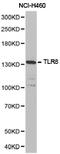 Toll Like Receptor 8 antibody, TA327055, Origene, Western Blot image 