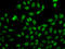 Gastrin cell antibody, STJ29166, St John