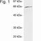 Ubiquilin 1 antibody, NB120-3341, Novus Biologicals, Western Blot image 