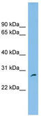 PH Domain Containing Endocytic Trafficking Adaptor 1 antibody, TA340351, Origene, Western Blot image 