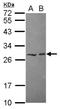 HECT Domain E3 Ubiquitin Protein Ligase 2 antibody, NBP2-16801, Novus Biologicals, Western Blot image 