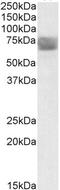 Tripeptidyl Peptidase 1 antibody, STJ72001, St John