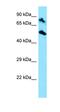 DNA Topoisomerase I Mitochondrial antibody, orb331347, Biorbyt, Western Blot image 