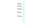 Rhabdomyosarcoma antigen MU-RMS-40.8 antibody, 28-201, ProSci, Western Blot image 