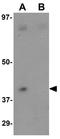 Coiled-Coil Domain Containing 69 antibody, GTX85190, GeneTex, Western Blot image 