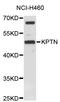 Kaptin, Actin Binding Protein antibody, STJ26692, St John