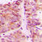 Ribosomal Protein S6 Kinase B1 antibody, LS-C352837, Lifespan Biosciences, Immunohistochemistry paraffin image 
