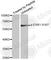 Estrogen Receptor 1 antibody, AP0348, ABclonal Technology, Western Blot image 