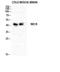 Tachykinin Receptor 1 antibody, STJ94496, St John