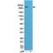 Acetyl-CoA Carboxylase Alpha antibody, P01802, Boster Biological Technology, Western Blot image 