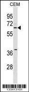 Spermatogenesis Associated Serine Rich 2 Like antibody, 59-726, ProSci, Western Blot image 