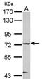 Checkpoint with forkhead and RING finger domains protein antibody, NBP2-15878, Novus Biologicals, Western Blot image 