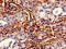 Vacuole Membrane Protein 1 antibody, LS-C679989, Lifespan Biosciences, Immunohistochemistry paraffin image 