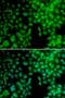 Vitamin D Receptor antibody, LS-C331974, Lifespan Biosciences, Immunofluorescence image 