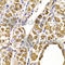 Septin 2 antibody, A5801, ABclonal Technology, Immunohistochemistry paraffin image 