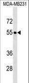 Forkhead Box Q1 antibody, LS-C159679, Lifespan Biosciences, Western Blot image 