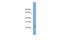 Chromosome 5 Open Reading Frame 24 antibody, A16782, Boster Biological Technology, Western Blot image 