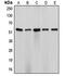 Cyp17 antibody, LS-C352100, Lifespan Biosciences, Western Blot image 