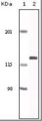 EPH Receptor A2 antibody, orb89261, Biorbyt, Western Blot image 