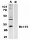 B-cell lymphoma/leukemia 10 antibody, 2161, QED Bioscience, Western Blot image 