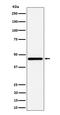 G Protein Subunit Alpha 13 antibody, M04160, Boster Biological Technology, Western Blot image 