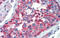 Lin-28 Homolog A antibody, 25-209, ProSci, Immunohistochemistry frozen image 