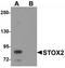 Storkhead Box 2 antibody, TA319971, Origene, Western Blot image 