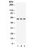 YES Proto-Oncogene 1, Src Family Tyrosine Kinase antibody, R31908, NSJ Bioreagents, Western Blot image 