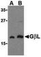 MTOR Associated Protein, LST8 Homolog antibody, PA5-20127, Invitrogen Antibodies, Western Blot image 