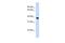 Acyl-CoA Binding Domain Containing 4 antibody, PA5-43438, Invitrogen Antibodies, Western Blot image 