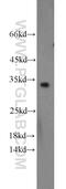 Cell Division Cycle Associated 4 antibody, 11625-1-AP, Proteintech Group, Western Blot image 