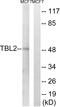 Transducin Beta Like 2 antibody, A07879, Boster Biological Technology, Western Blot image 