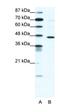 Gamma-Aminobutyric Acid Type A Receptor Pi Subunit antibody, orb327620, Biorbyt, Western Blot image 