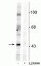 EPH Receptor B2 antibody, P01507-2, Boster Biological Technology, Western Blot image 