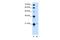 T-complex protein 10A homolog 2 antibody, PA5-42797, Invitrogen Antibodies, Western Blot image 