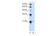 T-Complex 10 Like antibody, PA5-42797, Invitrogen Antibodies, Western Blot image 