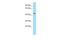 Solute Carrier Family 35 Member G2 antibody, A14288, Boster Biological Technology, Western Blot image 