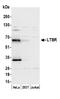 Lymphotoxin Beta Receptor antibody, A305-161A, Bethyl Labs, Western Blot image 