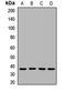 N-Acetylglucosamine Kinase antibody, LS-C668595, Lifespan Biosciences, Western Blot image 