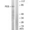 FES Proto-Oncogene, Tyrosine Kinase antibody, PA5-49781, Invitrogen Antibodies, Western Blot image 