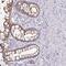 Ankyrin Repeat Domain 29 antibody, PA5-61962, Invitrogen Antibodies, Immunohistochemistry paraffin image 