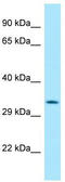 Hyaluronan Binding Protein 4 antibody, TA331261, Origene, Western Blot image 