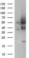 Ankyrin repeat and MYND domain-containing protein 2 antibody, LS-C788556, Lifespan Biosciences, Western Blot image 