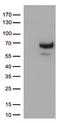 Matrix Metallopeptidase 2 antibody, LS-C798347, Lifespan Biosciences, Western Blot image 