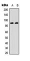 Inhibitor Of Nuclear Factor Kappa B Kinase Subunit Beta antibody, orb393325, Biorbyt, Western Blot image 