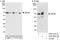 Zinc Finger And BTB Domain Containing 2 antibody, A303-262A, Bethyl Labs, Western Blot image 