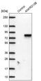 Ankyrin Repeat Domain 13B antibody, PA5-62510, Invitrogen Antibodies, Western Blot image 