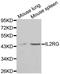 Interleukin 2 Receptor Subunit Gamma antibody, LS-C331714, Lifespan Biosciences, Western Blot image 